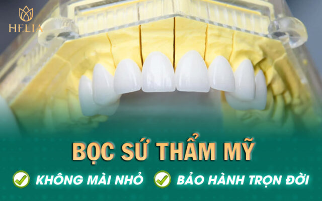 Bọc răng sứ không mài nhỏ chỉ có tại HELIA